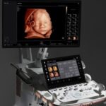 Samsung more products isuog 2025 hera z20 thumb728.jpg