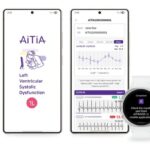Samsung mobile wearable health lvsd detection bci technology around the ear eeg thumb728 final.jpg